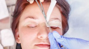 Blefaroplasti-Göz Kapak Estetiği-Göz Kapak Ameliyatı