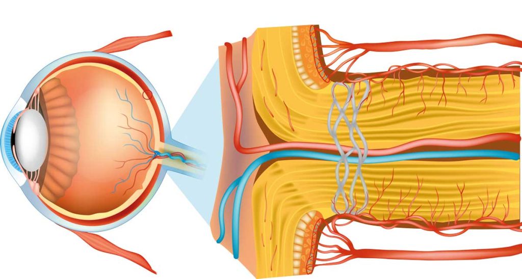 Travmatik Optik Nöropati
